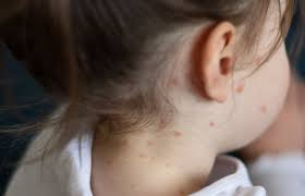 УЛААНБУРХАН ӨВЧНӨӨР НАС БАРСАН ТОХИОЛДОЛ 2 БОЛЛОО